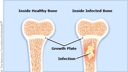 KidsHealth Image
