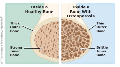 KidsHealth Image