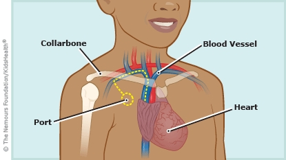 KidsHealth Image