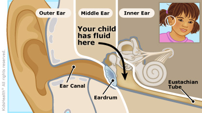 KidsHealth Image